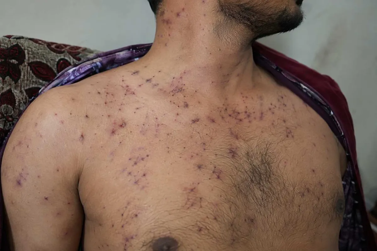 Ten Hit by Pellets on July 20, RTI Brings the Receipts